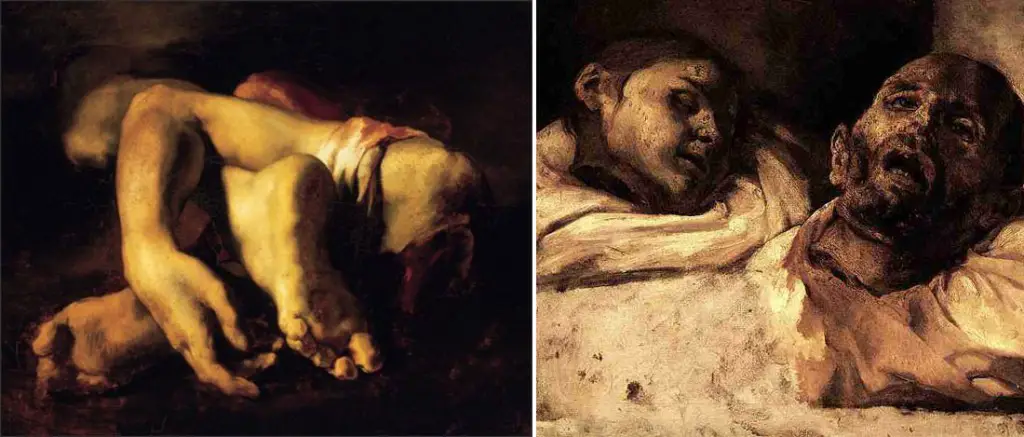Gericault anatomical studies are among the most disturbing pieces of art