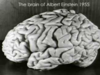 Einstein's brain would have to be one of t he strangest things ever stolen